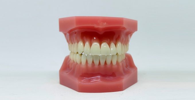 Invisalign Diamond Provider vs. Other Providers